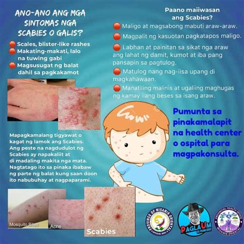 Galis (Scabies) .